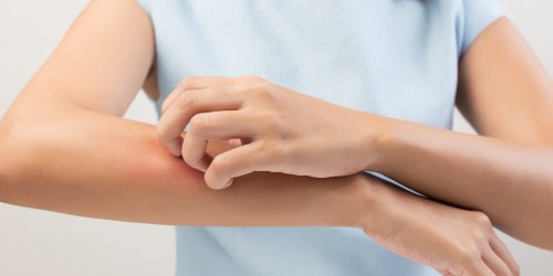 Coronavirus : les 7 erreurs a eviter en cas d-eczema !