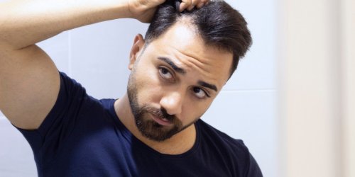 Calvitie : 5 aliments qui ralentissent la perte de cheveux des hommes