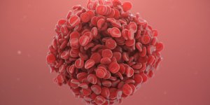 AstraZeneca : quels symptomes peuvent presager un caillot sanguin ?