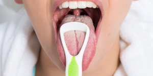 Leucoplasie : un signe de cancer de la bouche ?