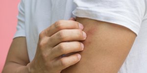 Allergie : qu-est-ce que l-urticaire geante ?