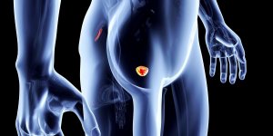 Cancer de la prostate : un generaliste condamne pour un diagnostic tardif