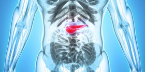 Triglycerides eleves : la complication qui touche le pancreas