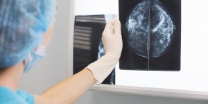 Atteinte d’un cancer, elle subit 20 seances de radiotherapie dans le mauvais sein