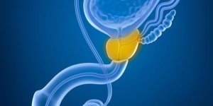 Prostatectomie par voie naturelle, comment ca marche ?