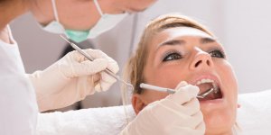 Dechaussement dentaire : la greffe de gencive comme traitement
