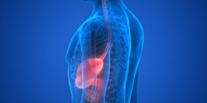 Inflammation digestive : comment soulager l-œsophagite ?