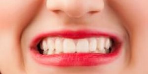 10 mauvaises habitudes qui abiment vos dents