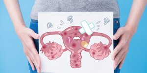Papillomavirus : pourquoi le depistage est primordial contre le cancer du col de l’uterus