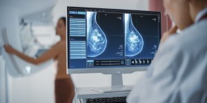 Cancer du sein : recourir a l’intelligence artificielle pour un meilleur depistage ?
