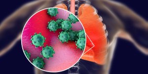 Epidemie de coronavirus : la France est-elle vraiment preparee ? 