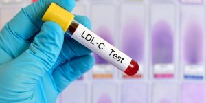Cholesterol LDL : qu-est-ce qu-est ?