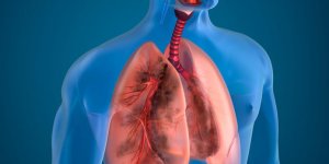 Cancer foudroyant du poumon : l-esperance de vie