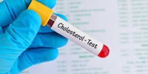 Cholesterol : les signes qui doivent alerter