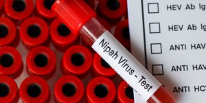 Nipah : qu’est-ce que ce virus qui sevit en Inde ?