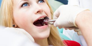 Gencives douloureuses : les dents de sagesse peuvent etre en cause