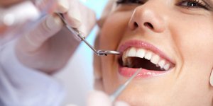 Blanchiment des dents chez le dentiste : le prix