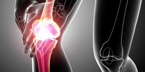 Arthrose du genou : ce geste qui peut soulager la douleur