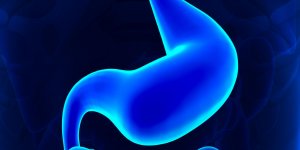 Cancer de l-estomac : le traitement par gastrectomie
