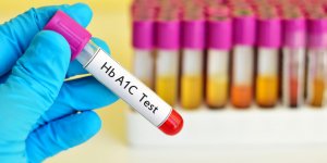 HbA1c : comment faire baisser l-hemoglobine glyquee ?