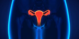 Cancer de l-ovaire : les differents stades
