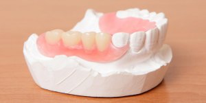 Protheses dentaires amovibles : tout le monde peut y avoir droit?