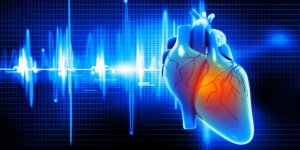 Arret cardiaque ou crise cardiaque : la difference