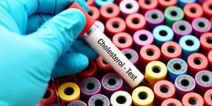Hypercholesterolemie : les taux a ne pas depasser