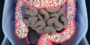 Cancer du colon : un nouveau test pour detecter la forme la plus frequente