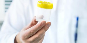 Myelome : le cancer que peuvent reveler vos urines