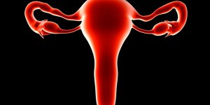 Cancer de l-uterus : 3 causes a connaitre