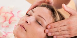Acupuncture : un traitement des acouphenes