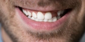 Ces maladies qui peuvent vous faire perdre vos dents