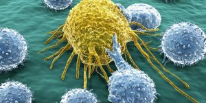 Lymphome du manteau : les cellules touchees par ce cancer