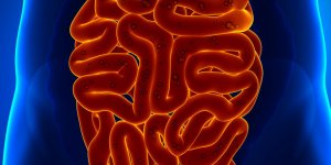 Cancer de l-intestin grele : une diarrhee motrice comme symptome