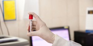 Maladie de Lyme : le diagnostic par prise de sang