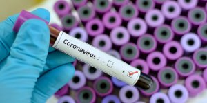 Coronavirus : le medecin qui avait lance l’alerte vient d’en mourir