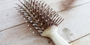 Chute de cheveux : un effet secondaire de l-implant contraceptif