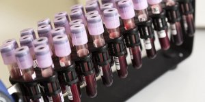 Cancer du sang : les differents traitements