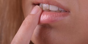 Prothese dentaire : que faire quand elle bouge ?