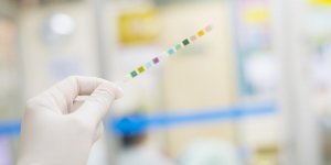 Diabete : a quoi servent les bandelettes de test urinaire ?