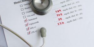Cholesterol LDL eleve et HDL bas : la mauvaise combinaison