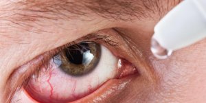Fatigue oculaire : un traitement par collyre