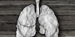 Cancer et metastase : la difference entre cancer primitif et secondaire du poumon
