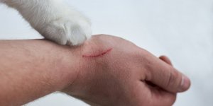Un homme contracte une septicemie a cause d’une griffure de chat