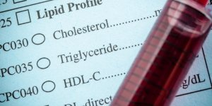 Triglycerides eleves : les valeurs qui doivent inquieter