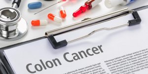 Cancer colorectal : 3 gestes qui favorisent la prevention