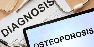 Fracture et osteoporose : 3 conseils
