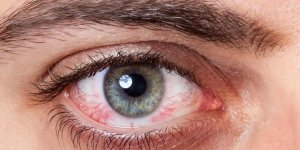 Qu-est-ce qu-une retinite pigmentaire ?