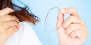 Cette pathologie des cheveux peut reveler un exces de cholesterol